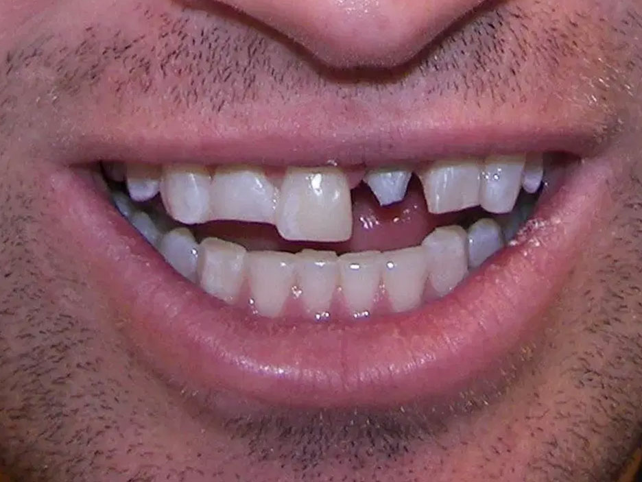 Before