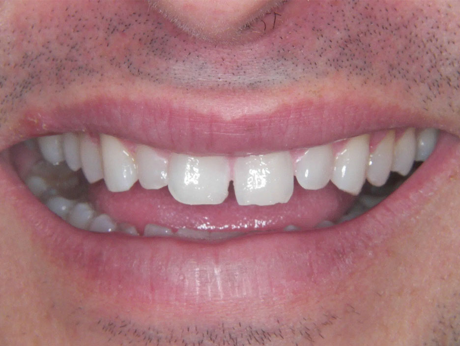Before